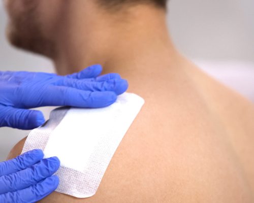 Collagen Dressings